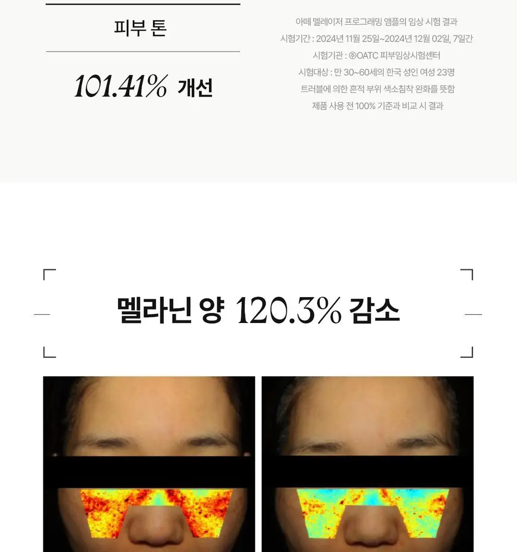 [미백앰플] 아떼 멜레이저 프로그래밍 앰플 10ml 5+1 상세페이지 30